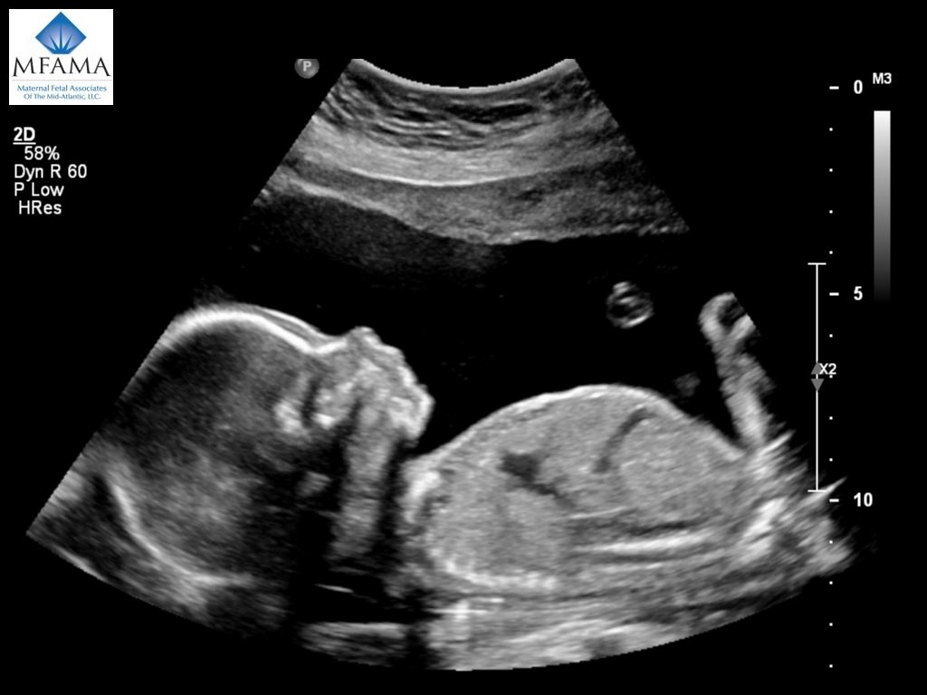 Anatomy Ultrasound Maternal Fetal Associates of the MidAtlantic