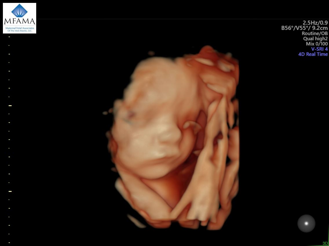 3d 4d Ultrasound Maternal Fetal Associates Of The Mid Atlantic