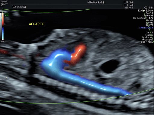 AIUM Certified in Fetal Echo